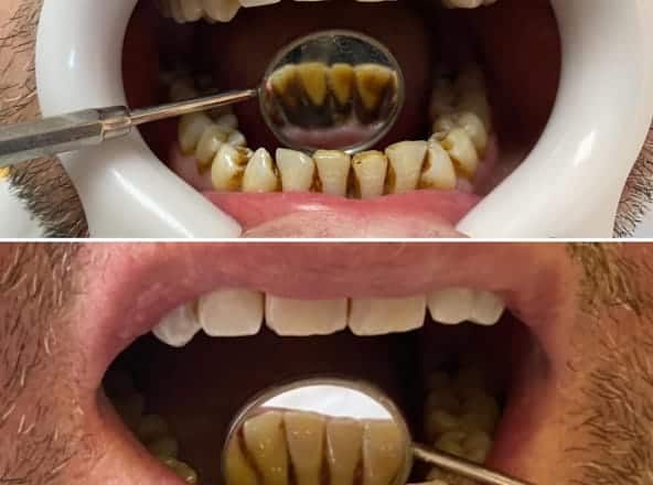 Çayyolu Diş Kliniği